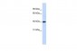 TFB1M antibody - N-terminal region